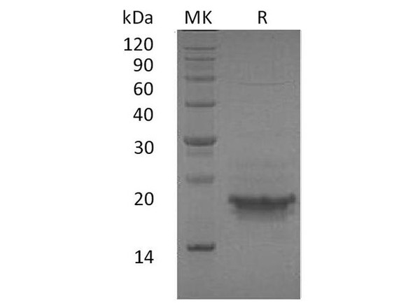 Human CD3 Epsilon/CD3E Recombinant Protein (RPES3250)
