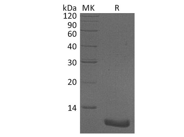 Human CXCL2/MIP-2 Recombinant Protein (RPES3251)