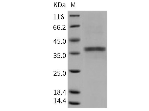 Mouse ACP5/TRAP Recombinant Protein (RPES3259)