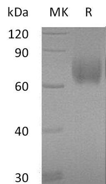 Human B7-H3/CD276 Recombinant Protein (RPES3262)