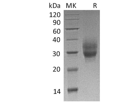 Cynomolgus 4BB/TNFRSF9/CD137 Recombinant Protein (RPES3293)