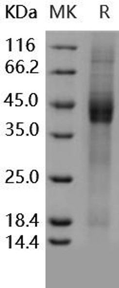 Human IGFBP3/IBP3 Recombinant Protein (RPES3296)