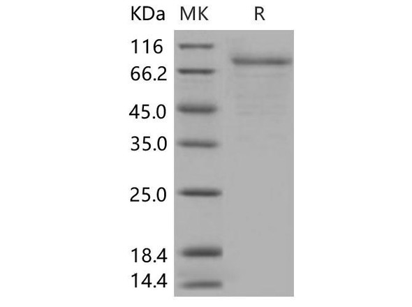 Human CSF2RA/GM-CSFR Recombinant Protein (RPES3300)