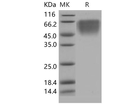 Human CD86/B7-2 Recombinant Protein (RPES3342)