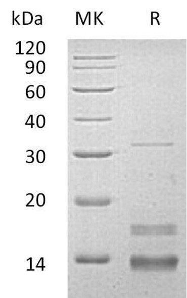 Human CD72/Lyb-2 Recombinant Protein (Trx&His) (RPES3362)