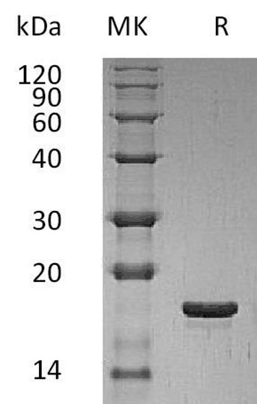 Human LIF Recombinant Protein (E.coli) (RPES3364)
