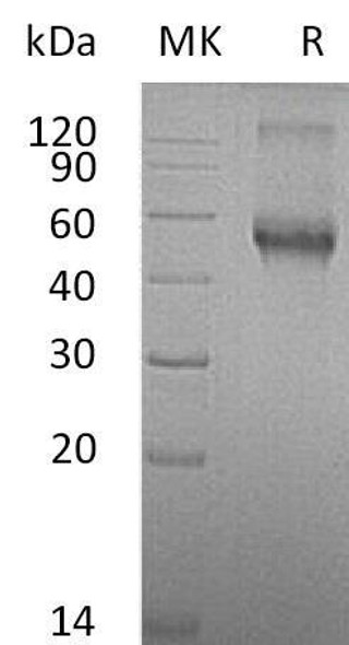 Mouse ALK/ACVRL1 Recombinant Protein (RPES3386)