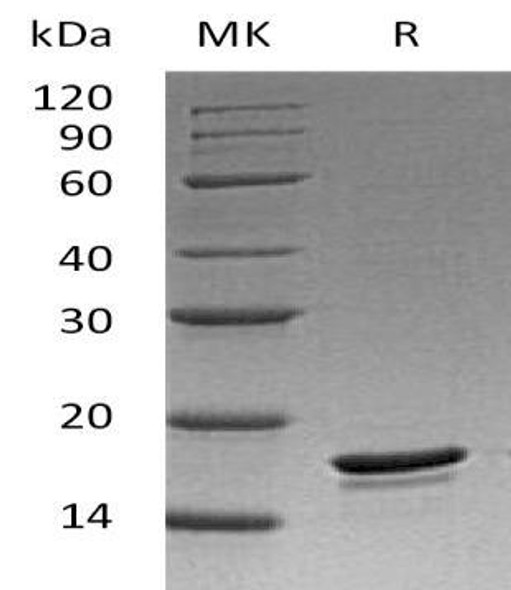 Human BCL-W/BCL2L2 Recombinant Protein (RPES3400)