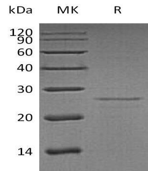 Human EIF4E Recombinant Protein (RPES3401)
