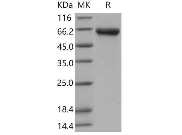 Mouse DKK3 Recombinant Protein (RPES3459)