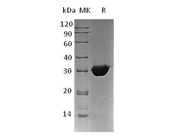 Human BPGM Recombinant Protein (RPES3462)