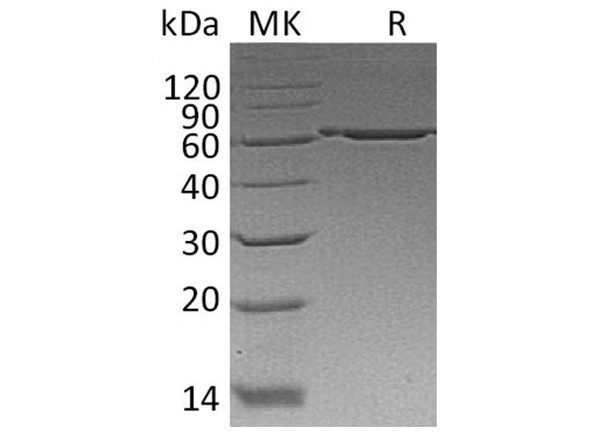 Human P4HB Recombinant Protein (RPES3471)