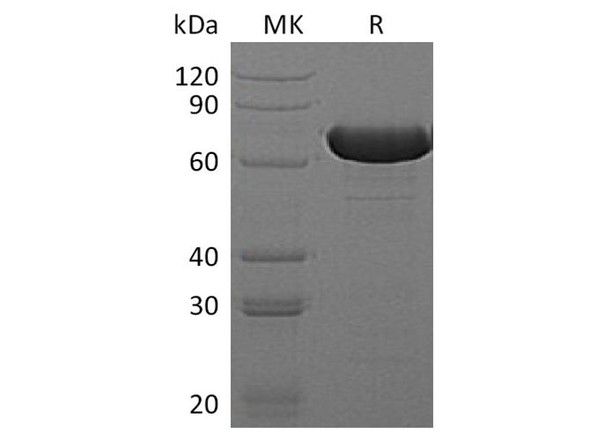 E.coli Beta-Gus Recombinant Protein (RPES3473)