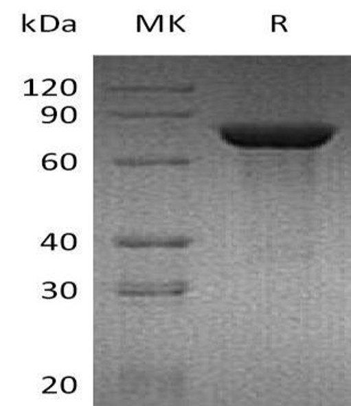 Mouse TGM2 Recombinant Protein (RPES3489)