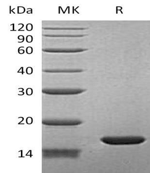 Human BLBP/FABP7 Recombinant Protein (RPES3504)