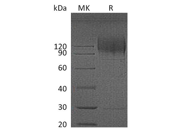 HIV HIV gp120 Recombinant Protein (RPES3514)