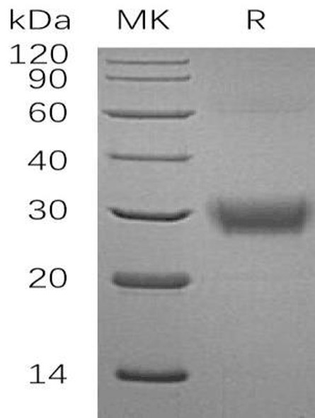 Human CD32a/FCGR2A Recombinant Protein (RPES3525)