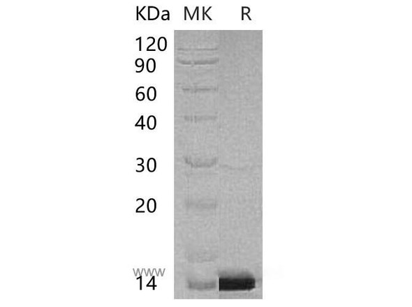 Human PCBD1 Recombinant Protein (RPES3527)