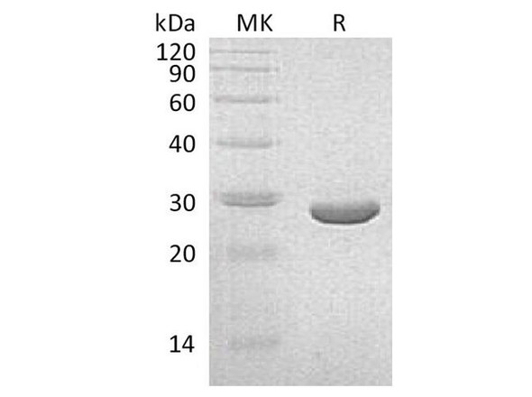 Klebsiella pneumoniae NEO Recombinant Protein (RPES3535)