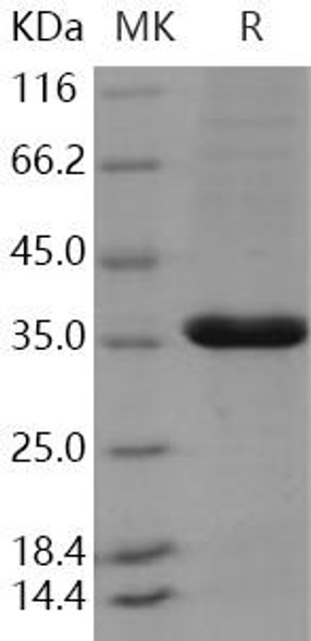 Human PCNA Recombinant Protein (RPES3558)