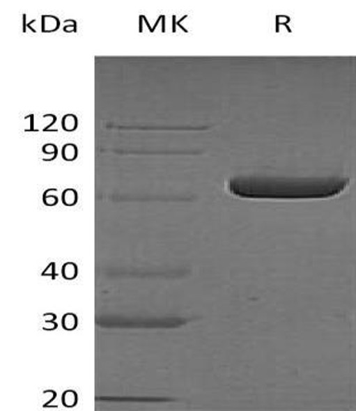 Human LTA4H Recombinant Protein (RPES3568)