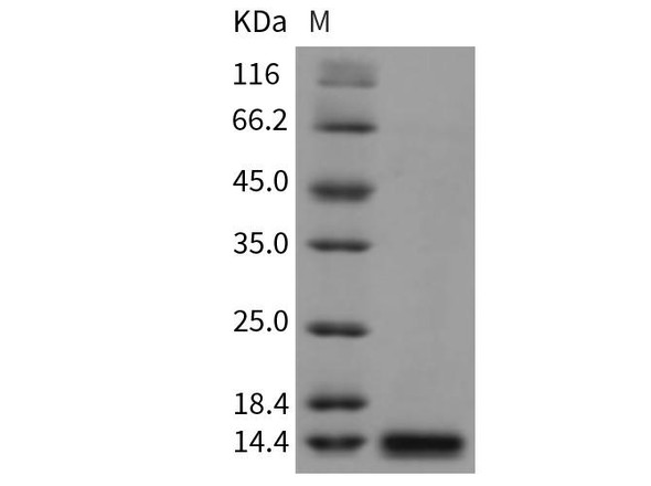 Rat Beta-2-microglobulin/B2M Recombinant Protein (RPES3582)