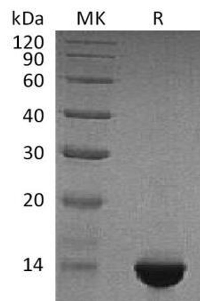 BNP Recombinant Protein (RPES3587)