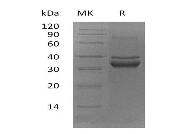 Mouse FN14/TWEAKR Recombinant Protein (RPES3613)