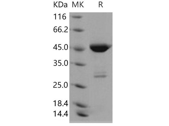 Human PGD Recombinant Protein (RPES3622)