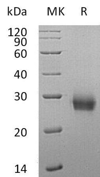 Human RANK/TNFRSF11A Recombinant Protein (RPES3631)
