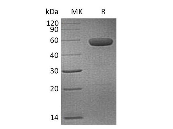 Human CD40/TNFRSF5 Recombinant Protein (RPES3638)