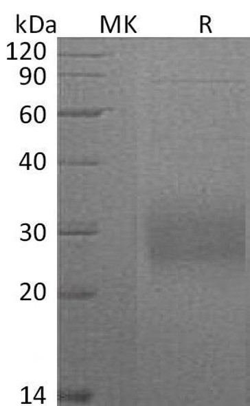 Human CD74 Recombinant Protein (RPES3665)