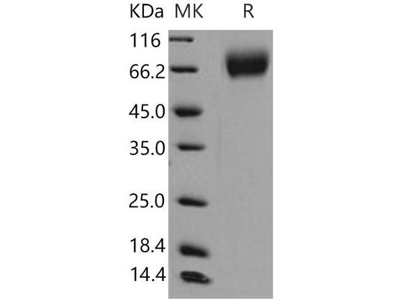 Mouse TrkB/NTRK2 Recombinant Protein (RPES3677)