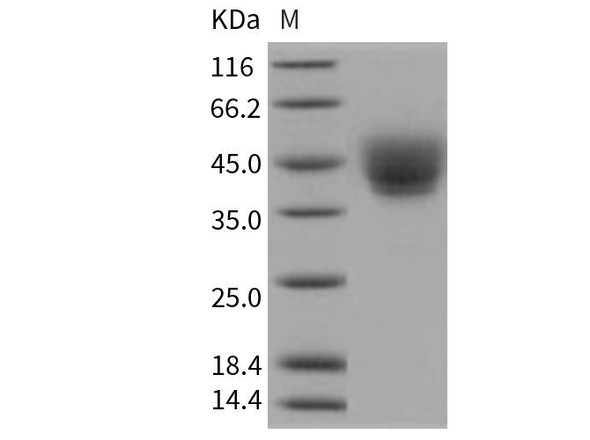 Human CD226/DNAM Recombinant Protein (RPES3693)