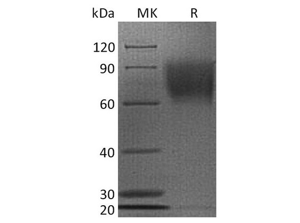 Human CD30/TNFRSF8 Recombinant Protein (RPES3705)