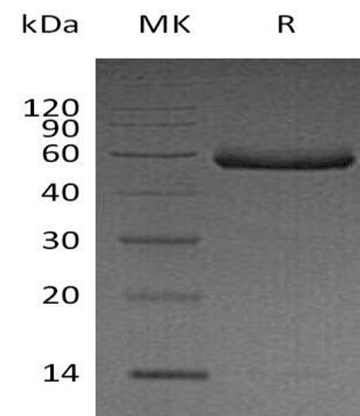 Human Fetuin-B/FETUB Recombinant Protein (RPES3716)