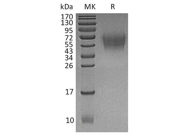 Human CD226/DNAM Recombinant Protein (RPES3725)