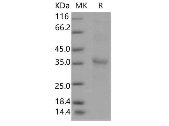 Human RGMA Recombinant Protein (RPES3728)