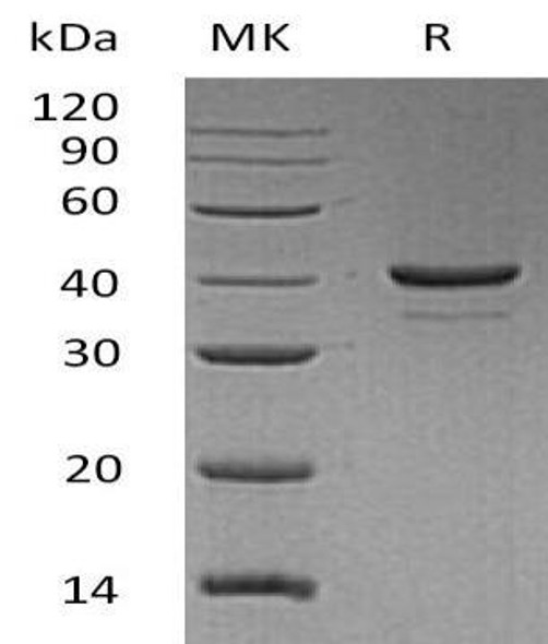 Human Resistin Recombinant Protein (RPES3739)