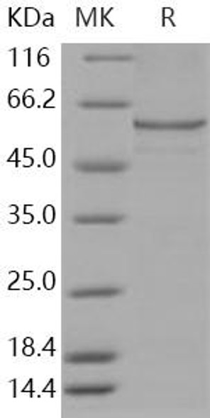 Human Catalase/CAT Recombinant Protein (RPES3751)