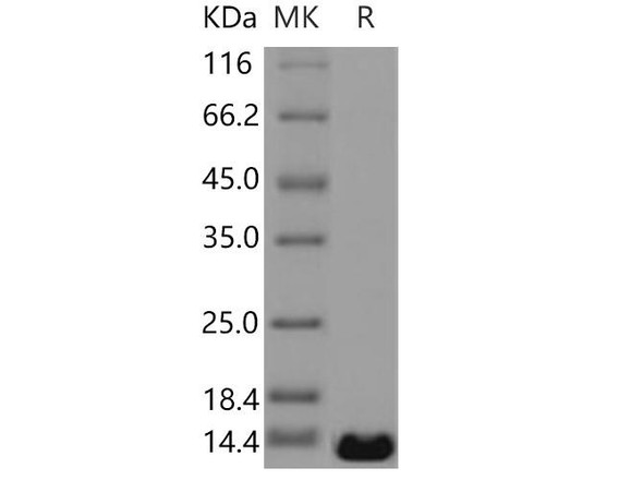 Human PTH2/PTRH2 Recombinant Protein (RPES3756)