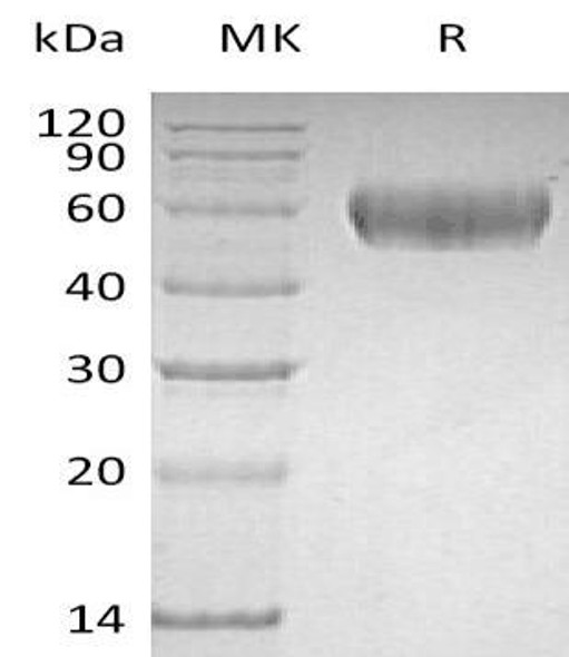 Human Lumican/LUM Recombinant Protein (RPES3760)