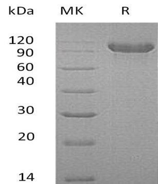 Human Cadherin6/CDH16 Recombinant Protein (RPES3779)