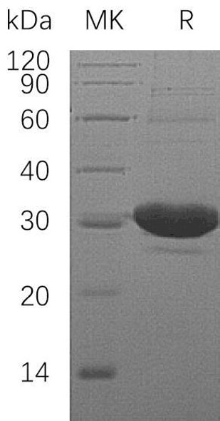 Human DCXR Recombinant Protein (RPES3781)