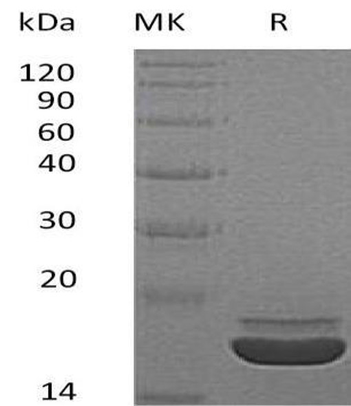 Human RARRES2/TIG2 Recombinant Protein (RPES3782)