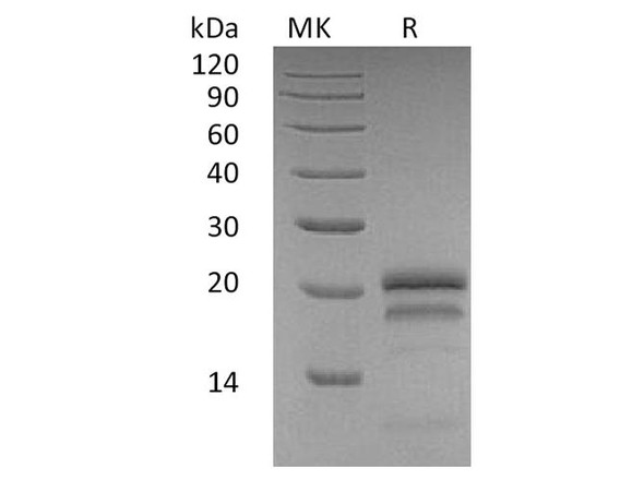 Human VEGF165/VEGFA Recombinant Protein  (RPES3789)