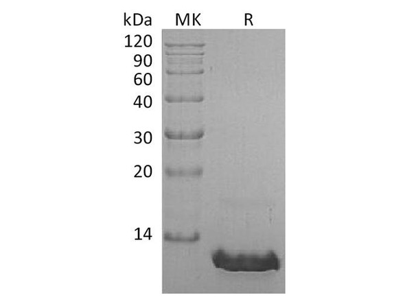 Human CCL8/MCP-2 Recombinant Protein (RPES3790)