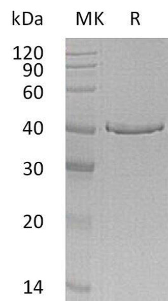 Human GMPR Recombinant Protein (RPES3792)