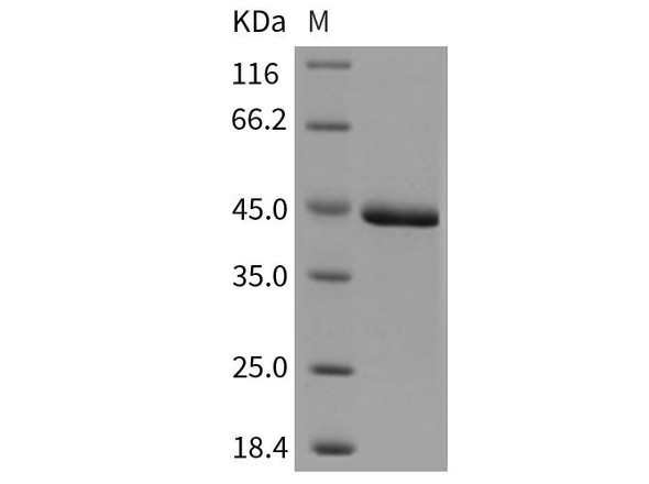 Mouse CHI3L1/YKL40 Recombinant Protein (RPES3797)