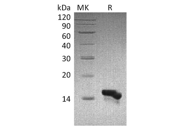 Human CCL28 Recombinant Protein (RPES3812)